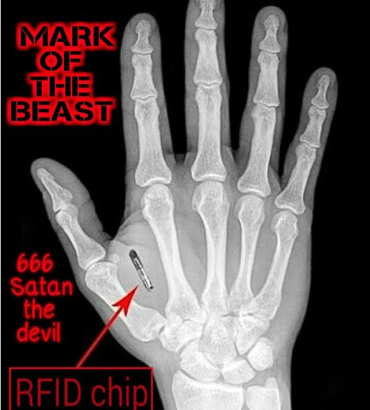 Many speculate the Mark of The Beast is a micro chip in hand or forehead allowing controlled, cashless transactions.